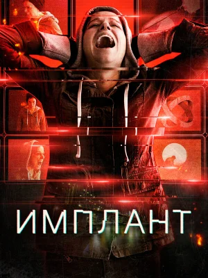 Имплант